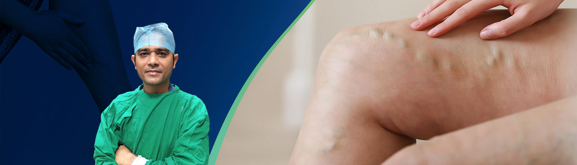 Varicose Veins Treatment – Find A Clinic Near You