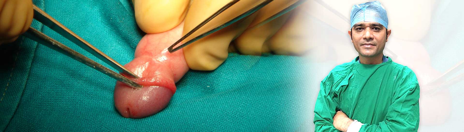 Discuss Phimosis Surgery